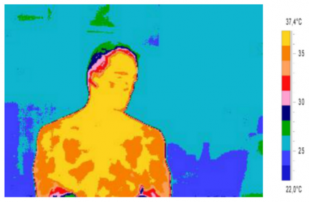 thermographie-de-l-amour-fig2-UGR