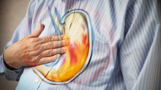 الحموضة والحرقة أهم المشاكل الصحية في رمضان