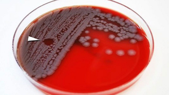 المصابون تعرضوا للعدوى عن طريق احتكاكهم بأبقار مصابة