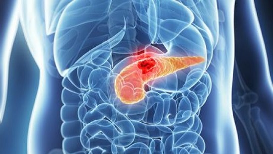 اختبار بول بسيط قد يكشف المراحل المبكرة لسرطان البنكرياس